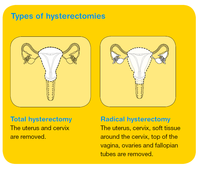 Hysterectomy Treatment Of Hysterectomy Types Diseases Hot Sex Picture