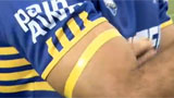 Tim Mannah's arm with a call to arms band