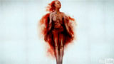 A blood stained body