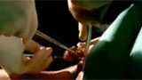 A scalpel cutting a patient