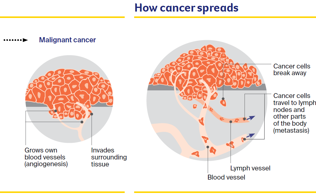 Diagram of how cancer spreads