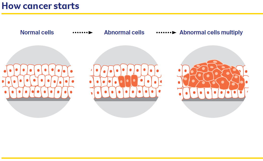 Diagram of how cancer starts