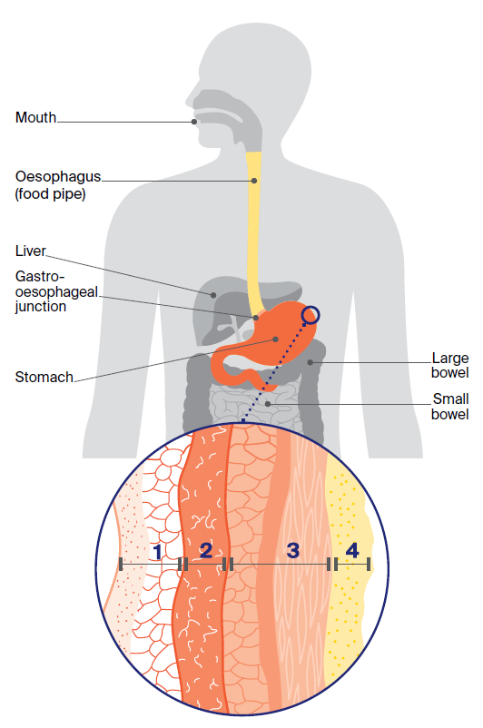 Diagram of the anatomy of the stomach