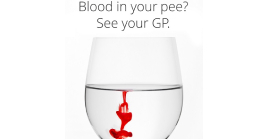 Red liquid staining water in a wine glass, like blood in urine