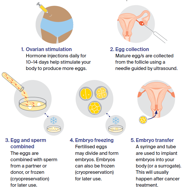 Simplified diagram of an IVF cycle