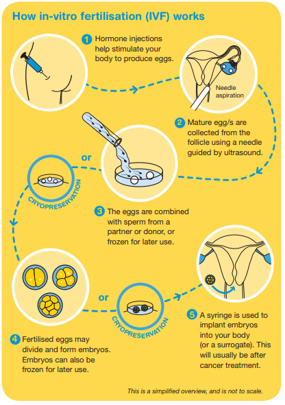 How in-vitro fertilisation (IVF) works