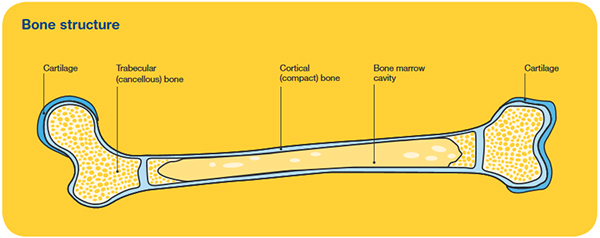 Primary Bone Cancer