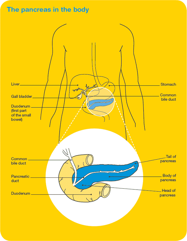 Simptomele cancerului de pancreas, factori de risc, diagnostic și tratament