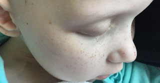 Six-year-old cancer patient Hayley